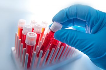 Gematologiya